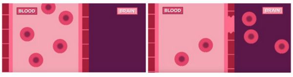 barrera-hematoencefalica.jpeg